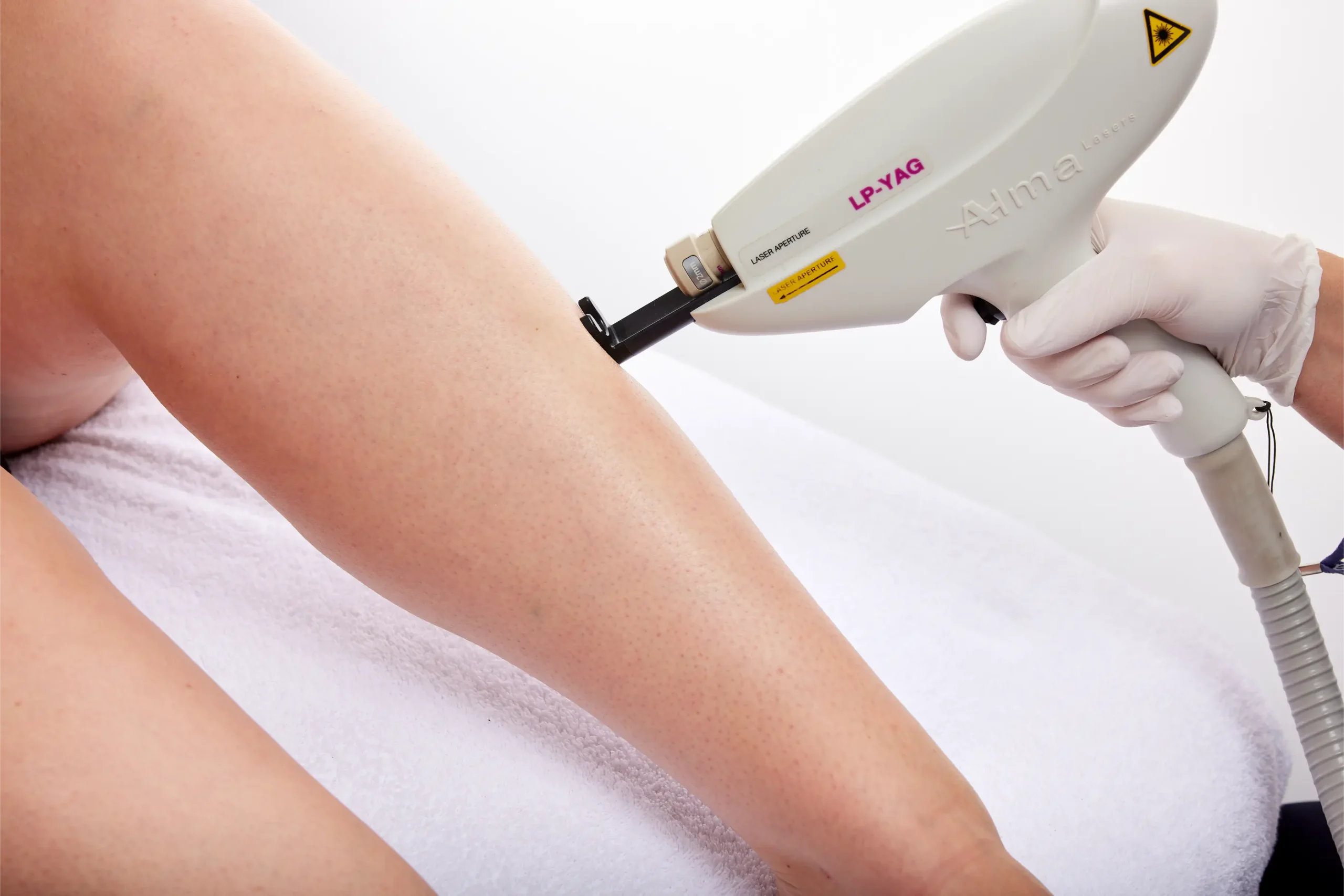 Laserontharing onderbeen Huidkliniek Gaaf